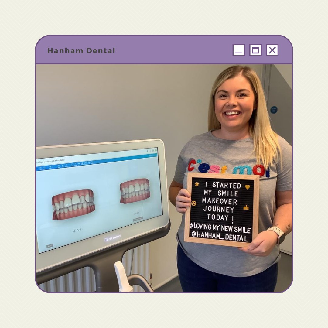 Another happy patient who started their Smile Makeover Journey😍 
Please send us a message or give us a call on 0117 960 2940💜⁠
.⁠
#transformingsmiles #newsmile #generaldentist #cosmeticdentist #cosmeticdentistry #generaldentistry