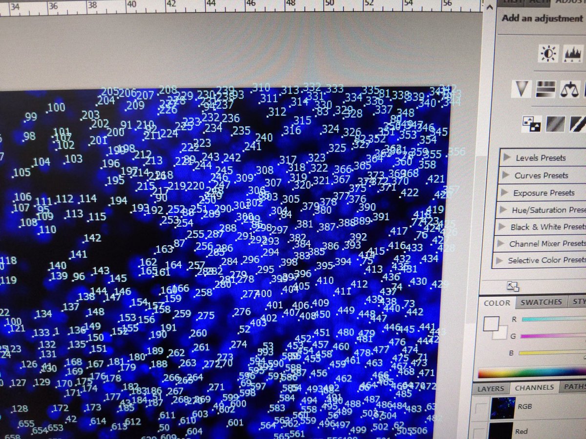 BioLens_Cells's tweet image. Cell counting is laborious but nessessary