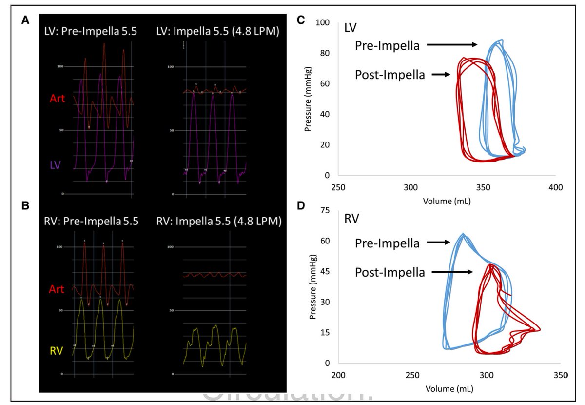 Patrick Sullivan (@psullivan000) on Twitter photo "Acute Effects of LV Support with #Impella 5.5 on Bi-Ventricular #PVLoop #Hemodynamics"
ahajournals.org/doi/10.1161/CI…
Congrats to <a href="/NavinKapur4/">Navin Kapur</a>, #KayEverett, #LaraReyelt, and all involved. Nice insight on bi-ventricular interdependece in #heartfailure and #shock.
#PVloops #mcs #LVAD "Acute Effects of LV Support with #Impella 5.5 on Bi-Ventricular #PVLoop #Hemodynamics"
ahajournals.org/doi/10.1161/CI…
Congrats to <a href="/NavinKapur4/">Navin Kapur</a>, #KayEverett, #LaraReyelt, and all involved. Nice insight on bi-ventricular interdependece in #heartfailure and #shock.
#PVloops #mcs #LVAD