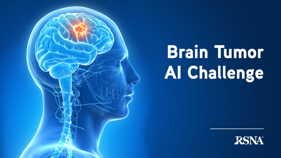 RSNA (@rsna) on Twitter photo Are you up for the challenge? Compete in the <a href="/RSNA/">RSNA</a>/<a href="/TheASNR/">The American Society of Neuroradiology</a>/<a href="/MiccaiS/">MICCAI</a> Brain Tumor Segmentation (BraTS) Challenge to improve brain tumor detection and treatment. Entries are due by October 12 and anyone can participate. bit.ly/3AMbcqM #RSNAI #RadAI #NeuroRad <a href="/kaggle/">Kaggle</a> Are you up for the challenge? Compete in the <a href="/RSNA/">RSNA</a>/<a href="/TheASNR/">The American Society of Neuroradiology</a>/<a href="/MiccaiS/">MICCAI</a> Brain Tumor Segmentation (BraTS) Challenge to improve brain tumor detection and treatment. Entries are due by October 12 and anyone can participate. bit.ly/3AMbcqM #RSNAI #RadAI #NeuroRad <a href="/kaggle/">Kaggle</a>