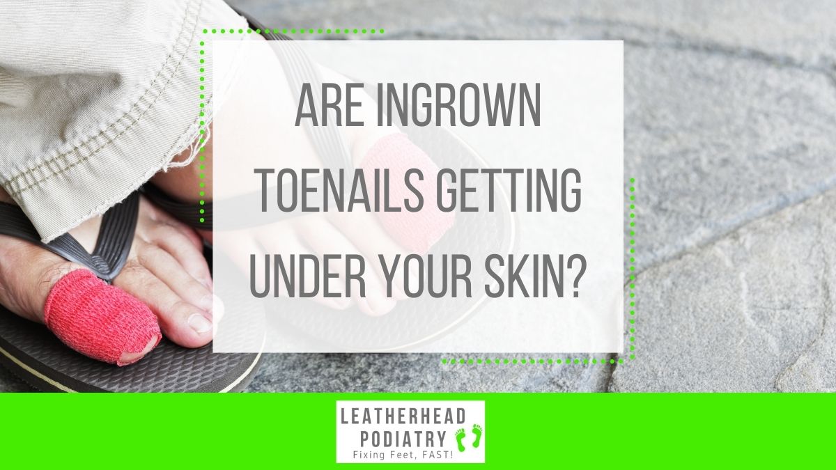 With symptoms including a painful, swollen big toe, or if the nail is curving to the side of your toe, ingrown toenails can get right under your skin (literally)! To see how we can help, give us a call on 01372 374125.

#Podiatrist #footspecialist #Leatherhead #Surrey