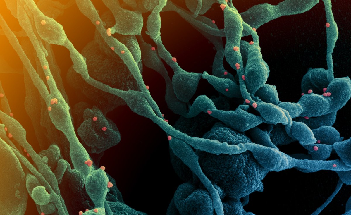 WHO, Partners Plan African Covid-19 Vaccine Tech Transfer Hub allafrica.com/view/group/mai… #Africa #Coronavirus #Covid19