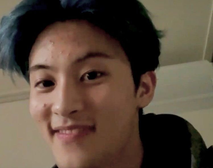 พี่มาร์คเป็นคนที่ยิ่งหน้าสดเเล้วก็ยังหล่อมากๆ เเถมยังดูมีเสน่ห์ขึ้นไปอีก เเล้วอันนี้ก็พิสูจน์เเล้วว่ามีสิวมันเป็นเรื่องธรรมชาติ ลบล้างความหล่อไม่ได้