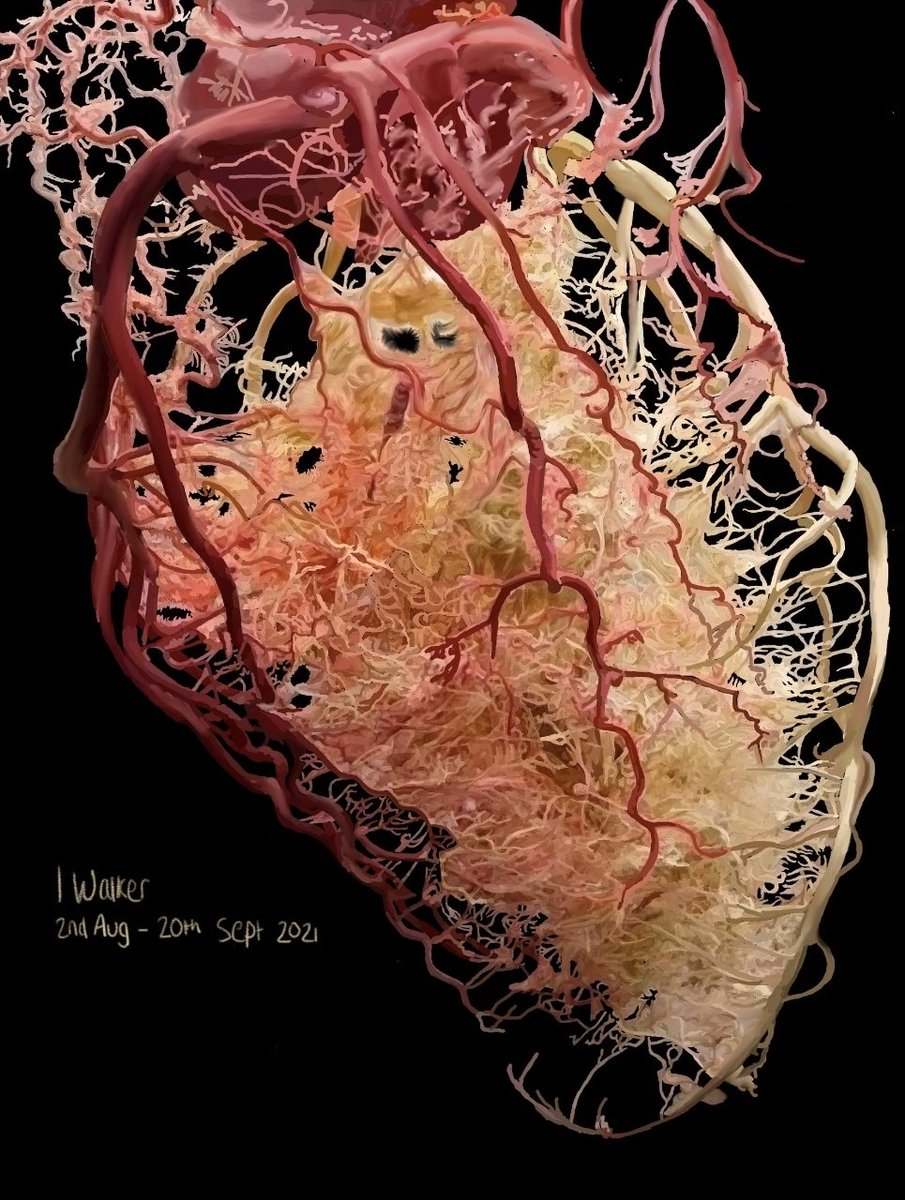 issywalker's tweet image. 1.5 months in the making. A heart full of love.