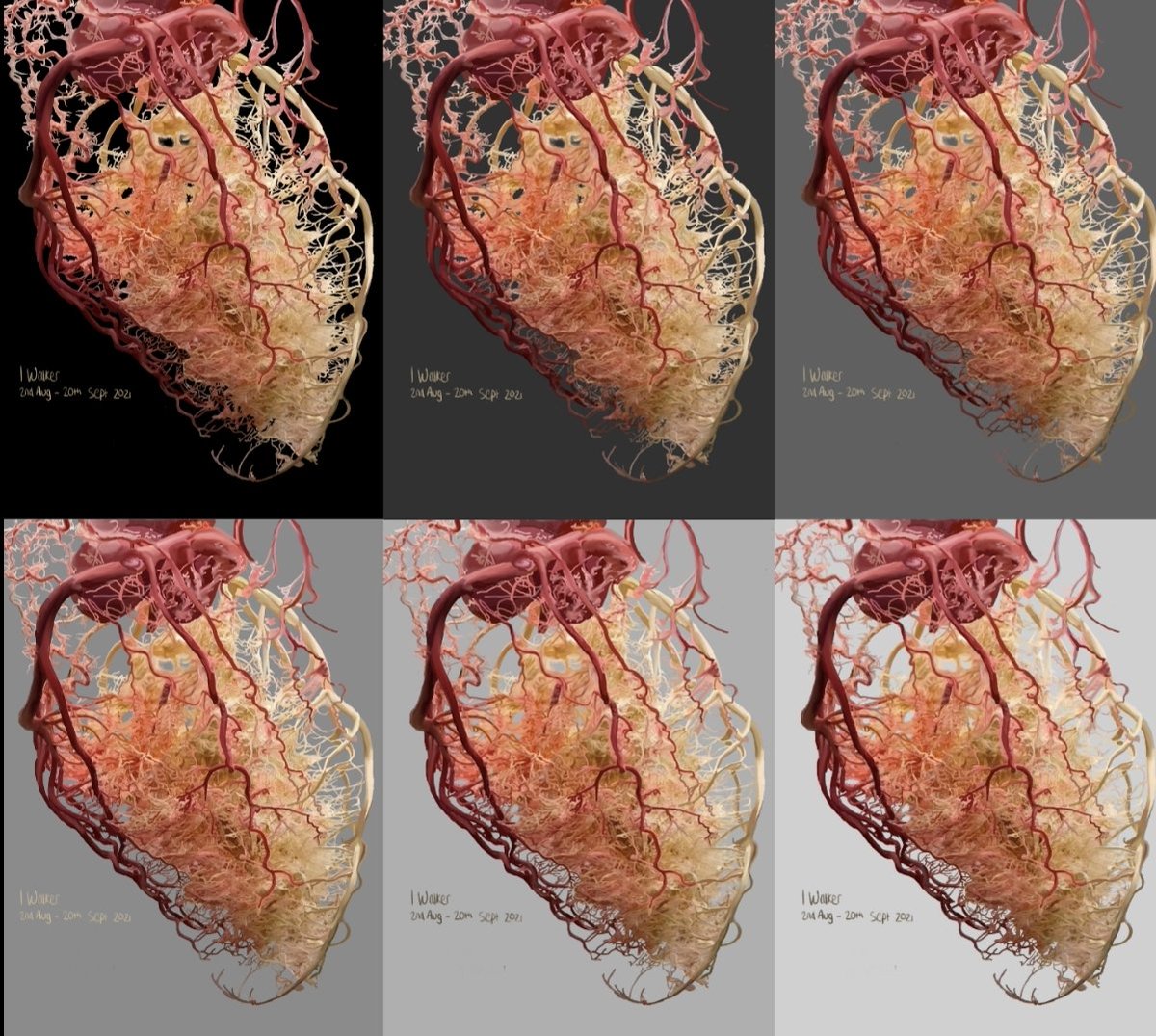 issywalker's tweet image. 1.5 months in the making. A heart full of love.