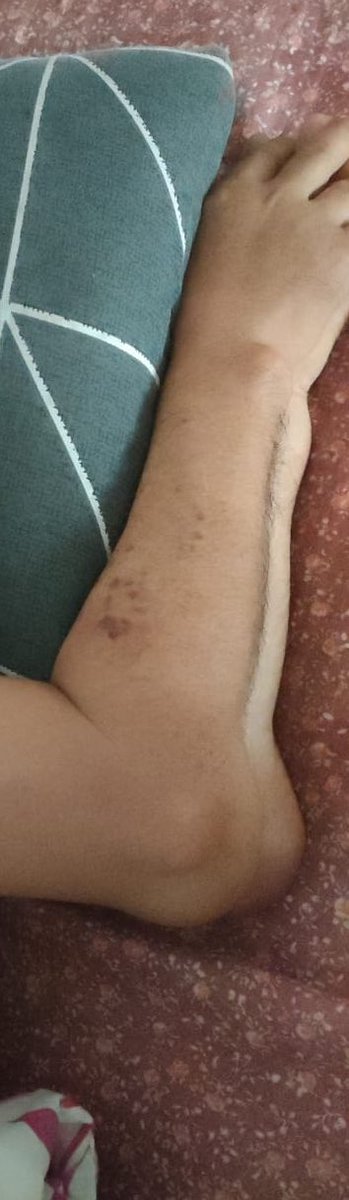 zumairaaa's tweet image. Kawan I Shah baru je diberhentikan kerja tau, lepas tu dpt tau pulak yg ayah dia skrg tgh struggle sakit batu karang dgn ketumbuhan acid gaut 🥺

So dia pun decide untuk kumpul duit slow2 dgn meniaga pisang goreng tepi jalan untuk operation ayah dia , jom bantu I RT guys 🙏