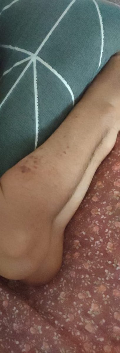 zumairaaa's tweet image. Kawan I Shah baru je diberhentikan kerja tau, lepas tu dpt tau pulak yg ayah dia skrg tgh struggle sakit batu karang dgn ketumbuhan acid gaut 🥺

So dia pun decide untuk kumpul duit slow2 dgn meniaga pisang goreng tepi jalan untuk operation ayah dia , jom bantu I RT guys 🙏