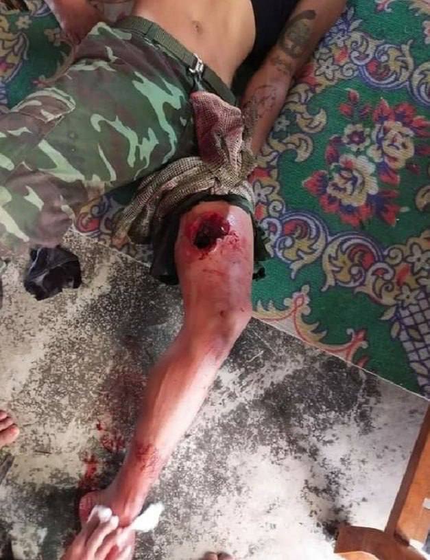 soeh07351's tweet photo. tw // dead Member of KPDF had killed &amp; at least 4 members got injured during the clashes with SAC terrorists KoneThar village, Demoso Tsp, Kayah State on Sep 20. 2 other members are missing as well. #Sep21Coup #WhatsHappeningInMyanmar https://t.co/lMouHmMObo