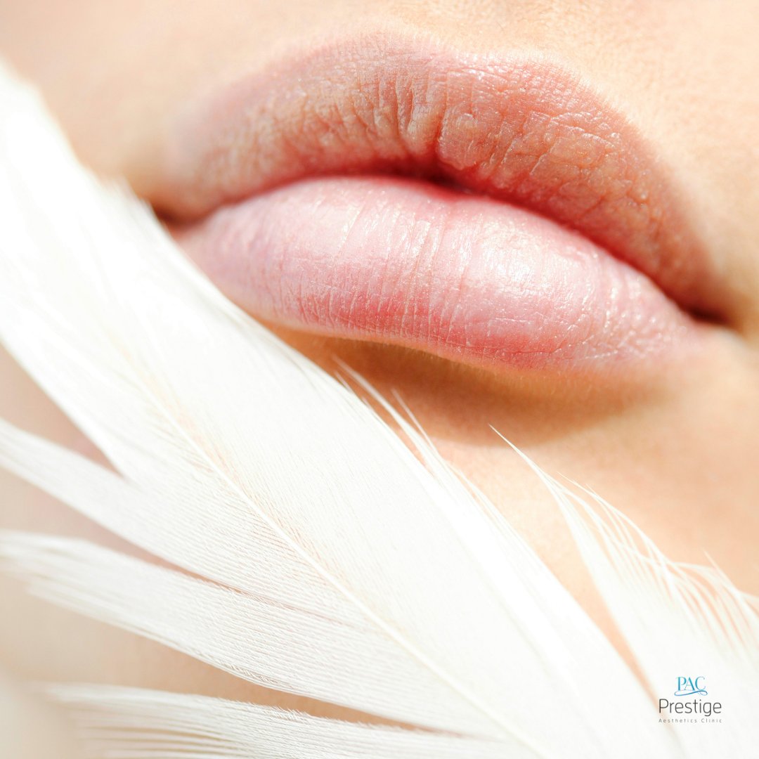 pacboca's tweet image. If you want to plump up thin lips or create a fuller look you are a good candidate for a Juvederm filler. Schedule your appointment now💄👄➡️ bit.ly/2VjGjpD

#confident #medspa #bocaraton #bocalife #lips #bocamedspa #miznerpark #beautiful