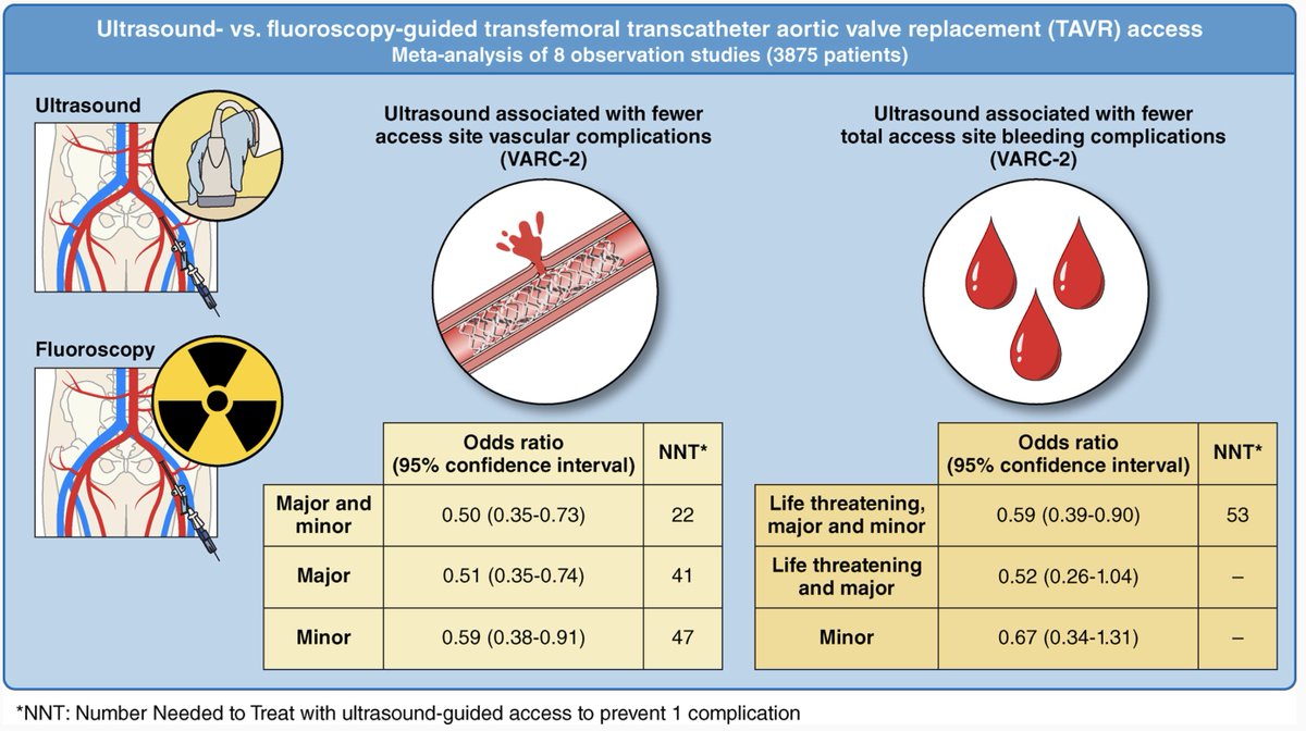 Salvatore Brugaletta (@sbrugaletta) on Twitter photo Ultrasound-guided TF access for #TAVR is superior to fluoroscopy-guided TF access in terms of vascular complications. And it does not take into account lower exposure of the operator to X-ray. #echofirst <a href="/PCRonline/">PCRonline 🫀</a> <a href="/mmamas1973/">Mamas A. Mamas</a> <a href="/CircIntv/">CircInterventions</a> <a href="/TCTMD/">TCTMD</a> ahajournals.org/doi/10.1161/CI… Ultrasound-guided TF access for #TAVR is superior to fluoroscopy-guided TF access in terms of vascular complications. And it does not take into account lower exposure of the operator to X-ray. #echofirst <a href="/PCRonline/">PCRonline 🫀</a> <a href="/mmamas1973/">Mamas A. Mamas</a> <a href="/CircIntv/">CircInterventions</a> <a href="/TCTMD/">TCTMD</a> ahajournals.org/doi/10.1161/CI…