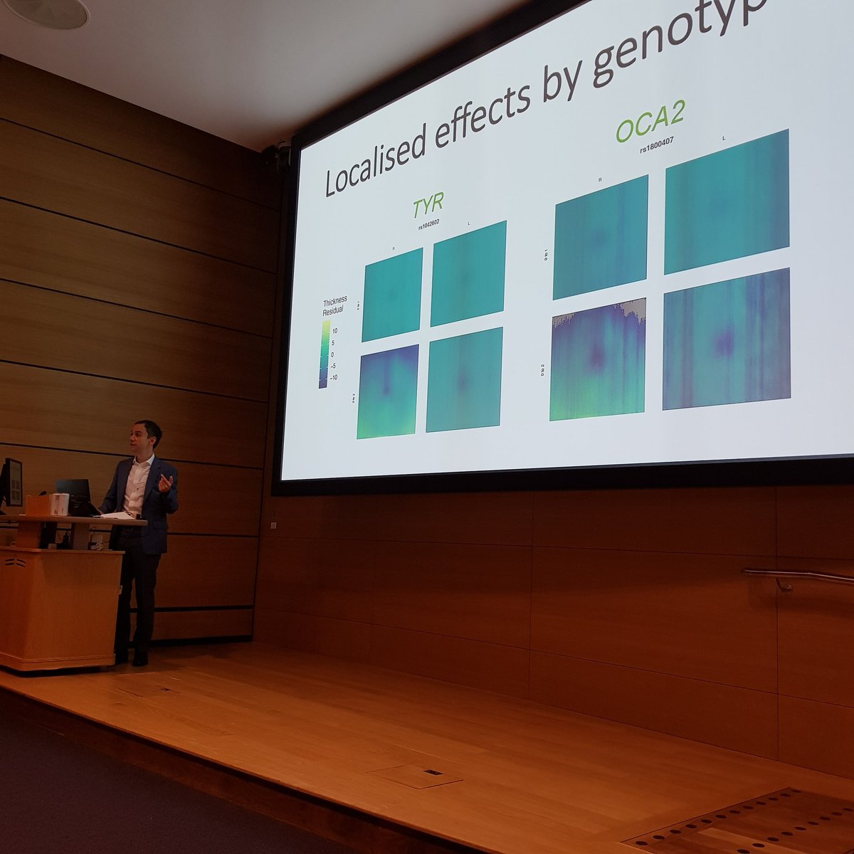UKEyeGenetics's tweet image. Fantastic start to #UKEGG21, learning about how far we have come in the world of #genetic #research into #InheritedEyeDisease, with Mendelian and complex genetic basis. Thanks to @anthonykhawaja for teaching us about risk factors in #glaucoma and identifying them in populations