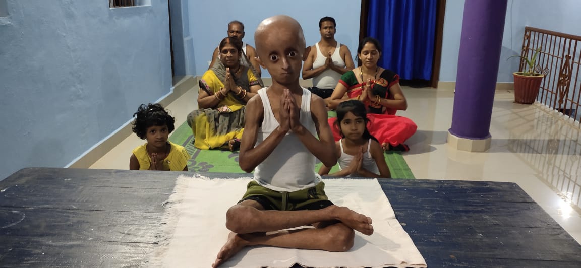 TeamNihal's tweet photo. Today on #InternationalYogaDay, 9-year old Aaditya encourages his family to perform Yoga with him. #progeria #raredisease @Progeria https://t.co/y12eG3STjh