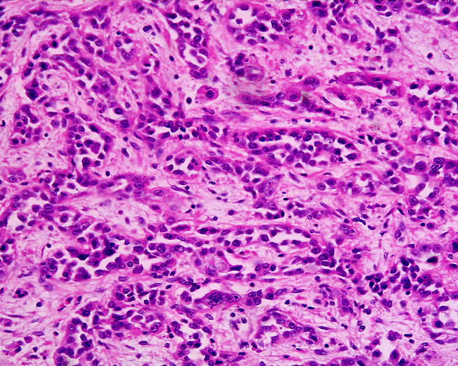 RSocPublishing's tweet photo. Disruption of transcription factor TFIIH generates a stress gene expression response and reveals possible new targets against cancer - new in #OpenBiology https://t.co/1UizjdWXlr https://t.co/b5WoUpVSTm