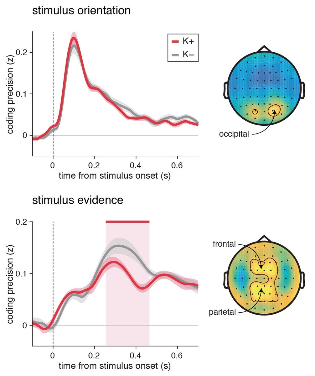 Multivariate pattern analyses of EEG activity confirmed these effects of ketamine, by showing intact visual processing of the stimuli, followed by degraded processing of the evidence each of them provides for the upcoming decision. (10/18)