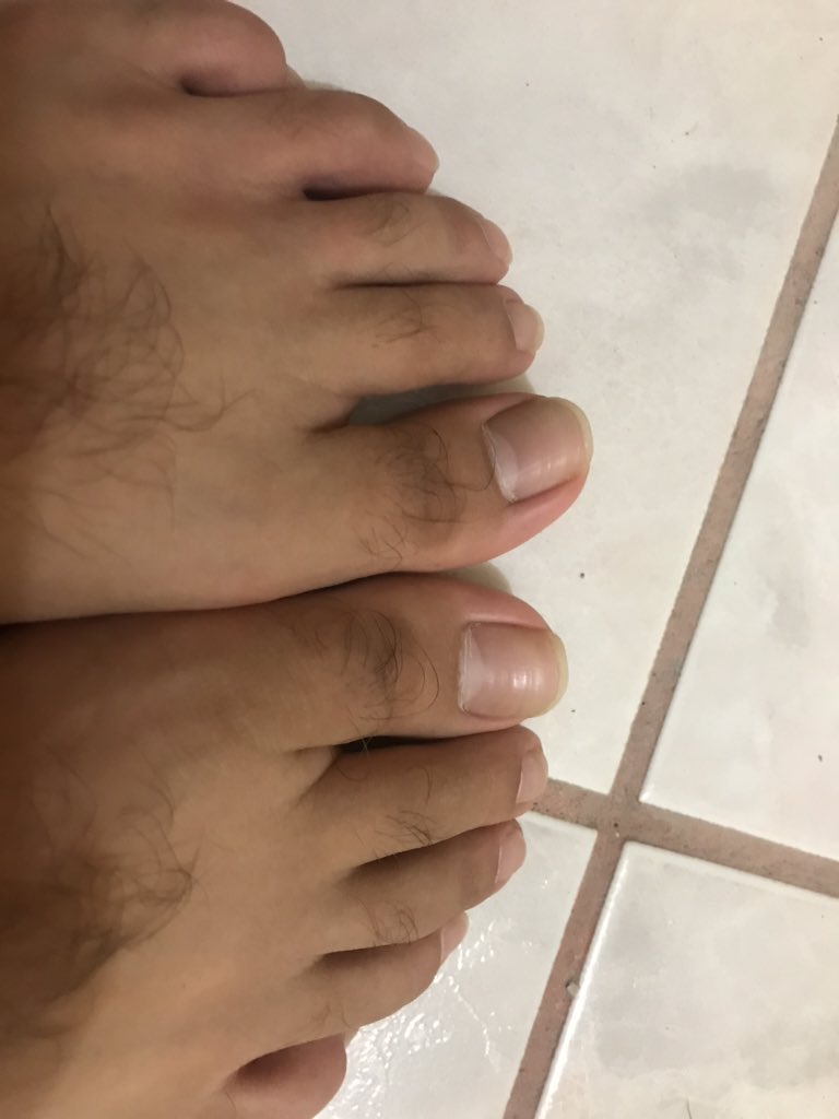 Foot1Tiny's tweet photo. @Dariofeet Los míos https://t.co/AVlgan6DO1