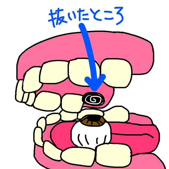 親知らずのtwitterイラスト検索結果