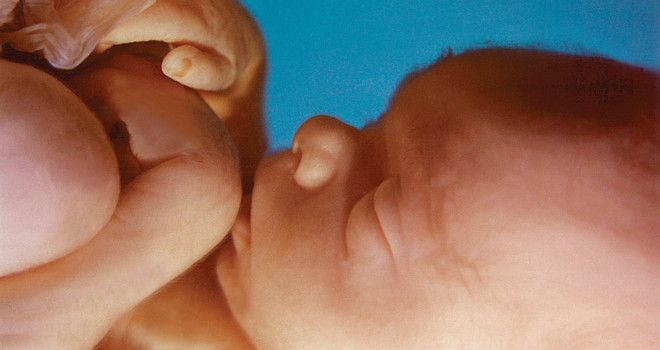 VICTORY!

Tennessee House Passes Pro-Life Bill Banning All Abortions Killing Unborn Babies 

buff.ly/3hGTJX1