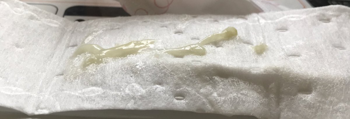 rinach310's tweet photo. かなり弾力あるオリモノ出ました🥰
ぷるんぷるんでねっとりです💕💦
密封して発送可能です。

#おりもの売ります #おりものシート売ります #パンツ売ります #下着売り子 #オリシー取引 #オリシー販売 #おりしー #おりものフェチ #愛液売ります https://t.co/XFhD5oCqct