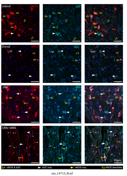 bioImaging_NCL's tweet photo. Recent work by @OlthofB investigating the role for nitric oxide in serotonin #neurons of the midbrain raphe nuclei is out in @EJNeuroscience. #Confocal images were collected on #LSM800 miscroscope at the @bioImaging_NCL facility.
https://t.co/2J7tKQev8F https://t.co/KcCxRNrQDW