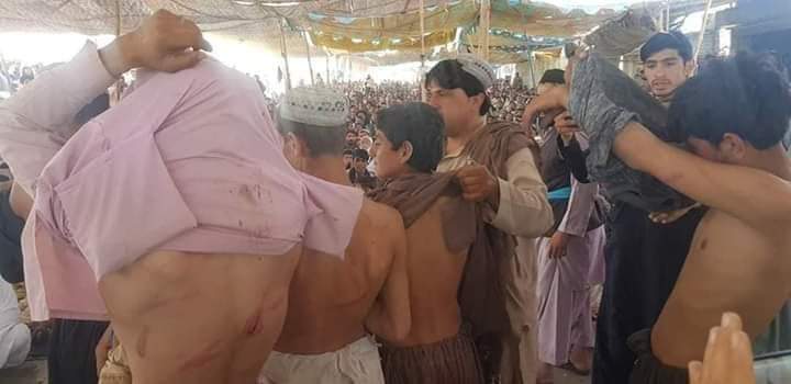 ShakimjanBaghi's tweet photo. چمن کے پرامن دھرنا پر یف سی کی طرف سے سخت تشدد ہوا ہے ۔ یہ ایک ناروا عمل ہے ۔ اور ریاست کی اس ناروا کاروائی کی ہم سخت الفاظ میں مذمت کرتے ہیں ۔
#StateViolance
@AliWazirFans @JessPash2 @kAfghaan https://t.co/ODyxedTqIS