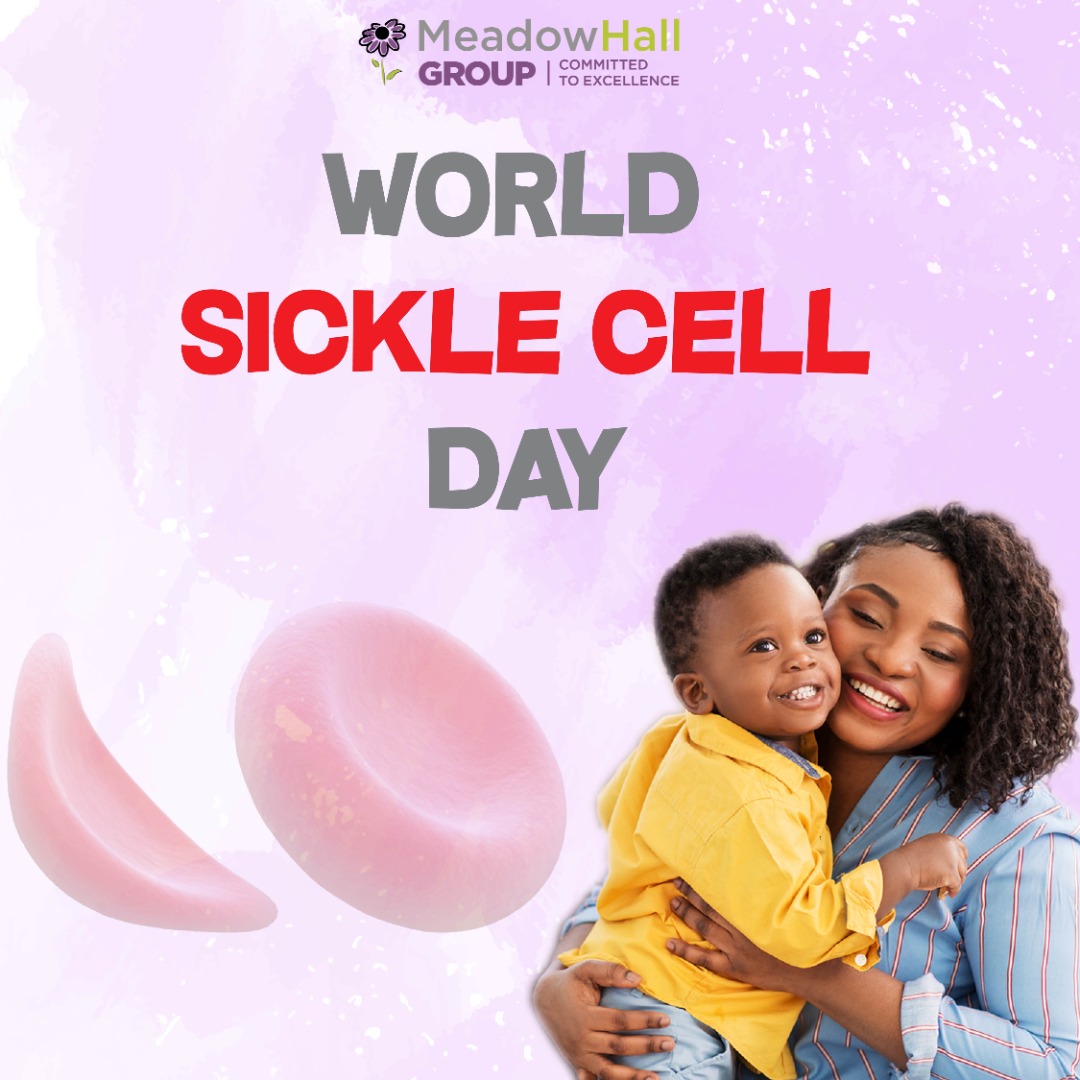 MeadowHallGroup's tweet photo. Did You Know?
•SCD is inherited from both parents; sickle cell trait is inherited from one parent.
•SCD can affect anyone, although it predominantly affects people from African and Caribbean backgrounds.
•1 in 76 babies born in the UK carry sickle cell trait. https://t.co/QgkCta3nEt