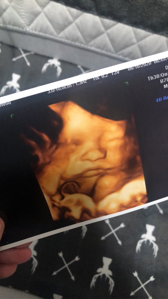 TaraUsrey's tweet photo. I never post on here anymore but I have a little over 8 weeks left with baby no name 😅😩😂 https://t.co/ulqg7RnMHS