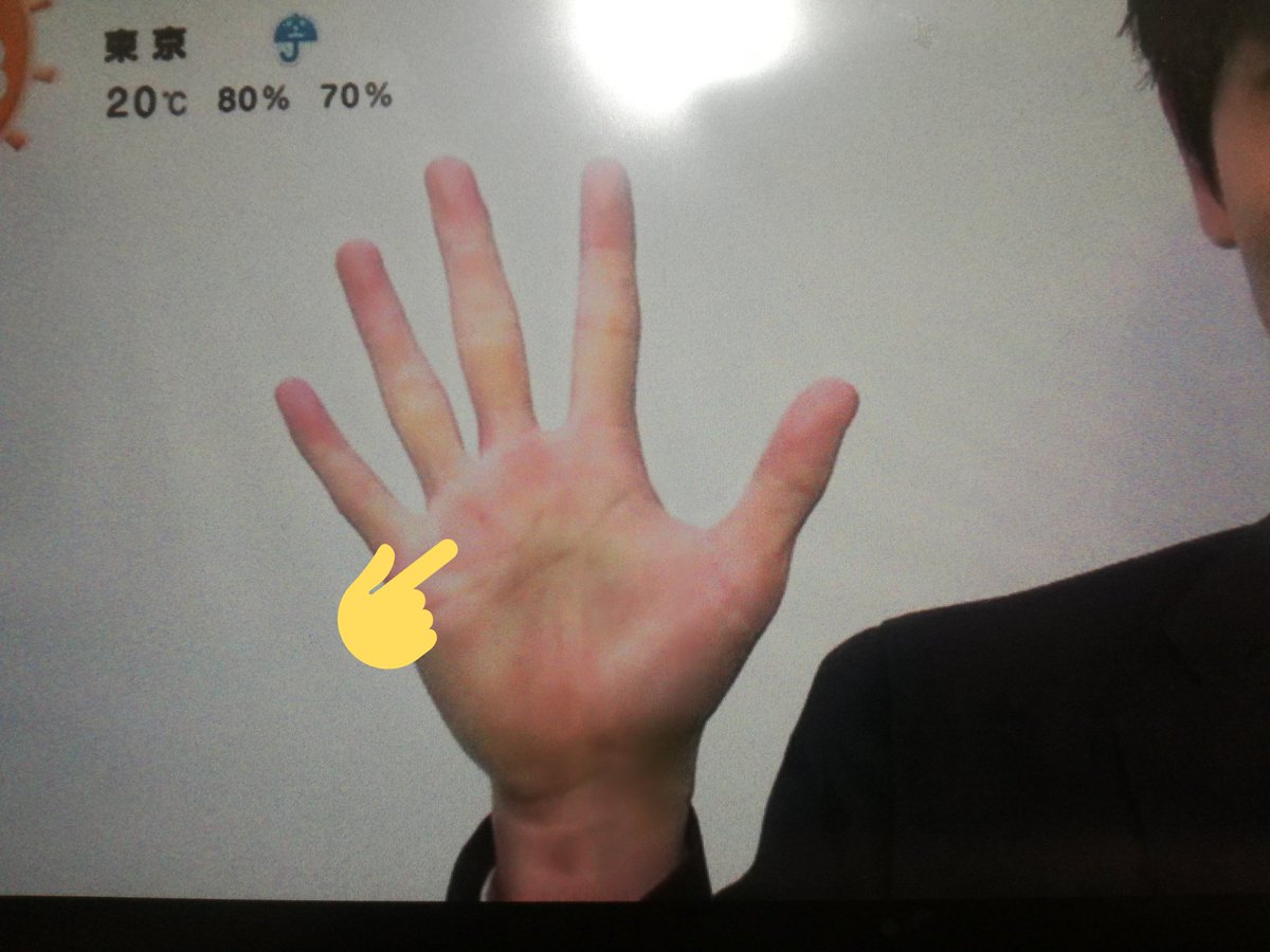 せやな スマイリー With You こーち君右手のひらにほくろあるんだね この画像じゃ分かりにくいけど しょっぴーは左 手のひらに同じようにほくろある これはどんな手相なんだろ 後で調べてみよう 髙地優吾 渡邊翔太