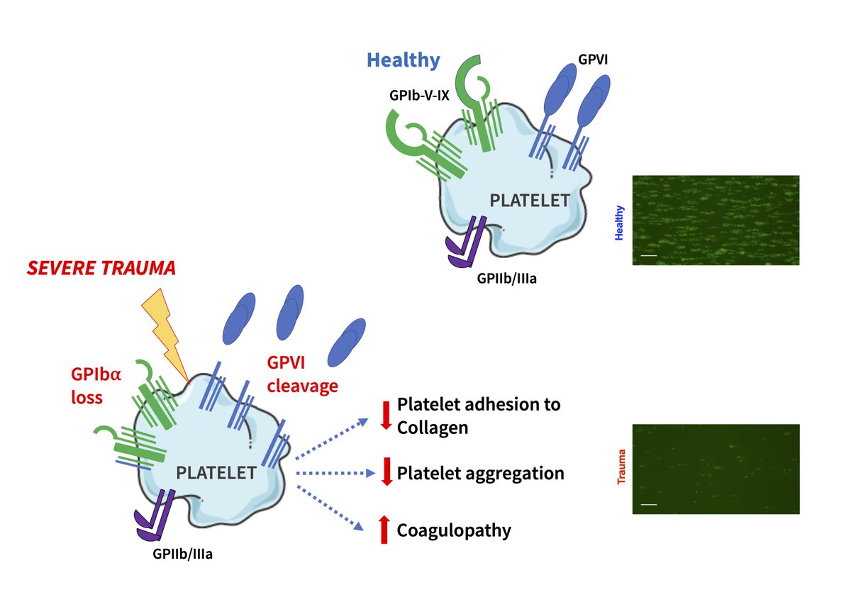 Happy to share our latest paper in <a href="/BloodAdvances/">Blood Advances</a> showing loss of GPVI is key to trauma-induced #platelet dysfunction and associated with reduced hemostatic competence and increased mortality. Great work by <a href="/Paulvulliamy/">Paul Vulliamy</a> <a href="/blizard_inst/">Blizard Institute</a> <a href="/QMULBartsTheLon/">Barts and The London, Queen Mary</a> bit.ly/2V04ERT