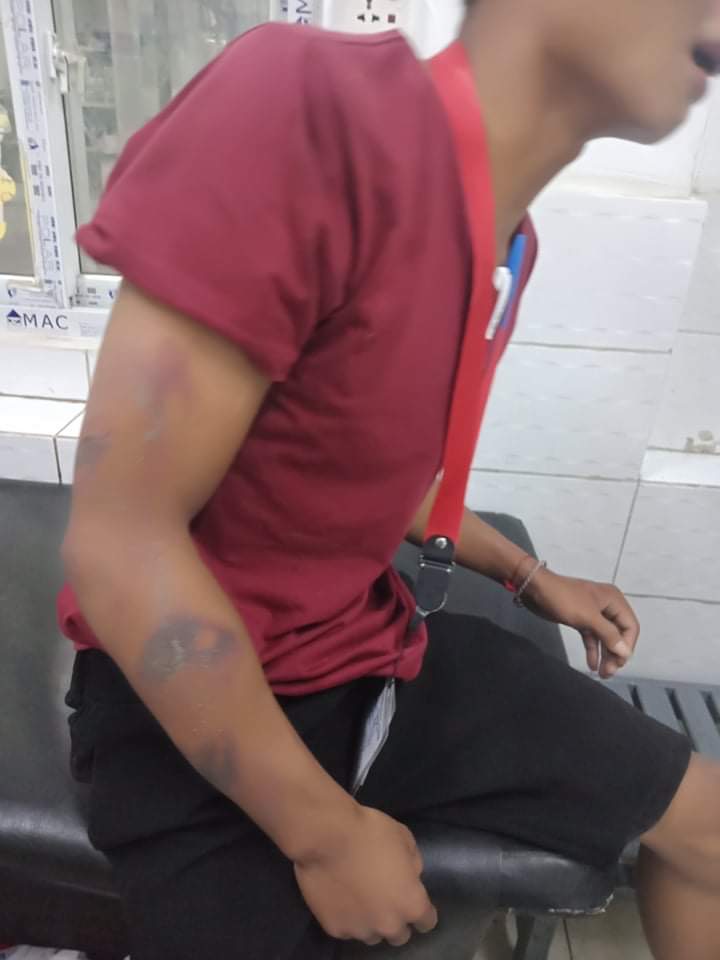 AndrewTSaks's tweet photo. Trabajadores de una fabrica de @Primark en Myanmar atacado por matones por ser sindicalistas. La semana pasada  despidieron 30 sindicalistas, hoy les atacaron brutalmente.  Asi hace la ropa de Primark. Hemos contactado a Primark muchas veces sin repuest. https://t.co/0er1K3rl2b