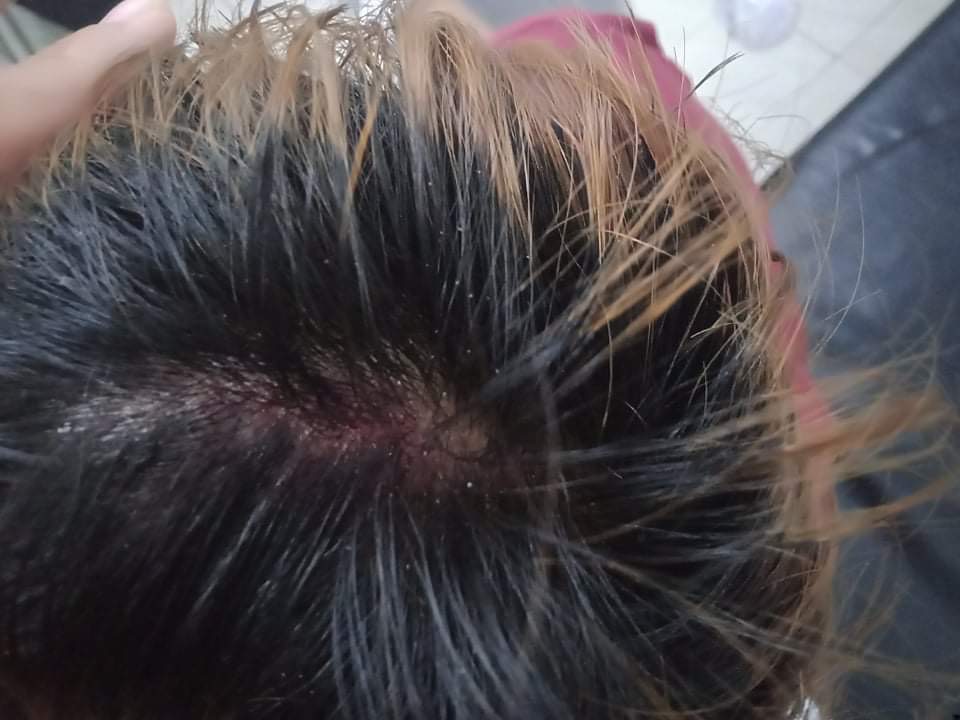 AndrewTSaks's tweet photo. Trabajadores de una fabrica de @Primark en Myanmar atacado por matones por ser sindicalistas. La semana pasada  despidieron 30 sindicalistas, hoy les atacaron brutalmente.  Asi hace la ropa de Primark. Hemos contactado a Primark muchas veces sin repuest. https://t.co/0er1K3rl2b