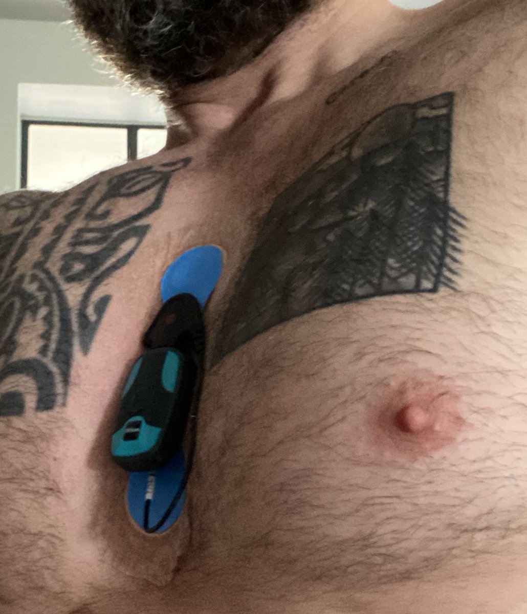 DrChrisMoRo's tweet photo. Heart failure life! Having a few more checkups - it’s never ending. When I think I have grown my chest hair again - off it goes 🤪🤪🤪#heartfailure #svt #leftventriculardysfunction #chest #hairy @TheBHF https://t.co/ZiBZNJo1AI