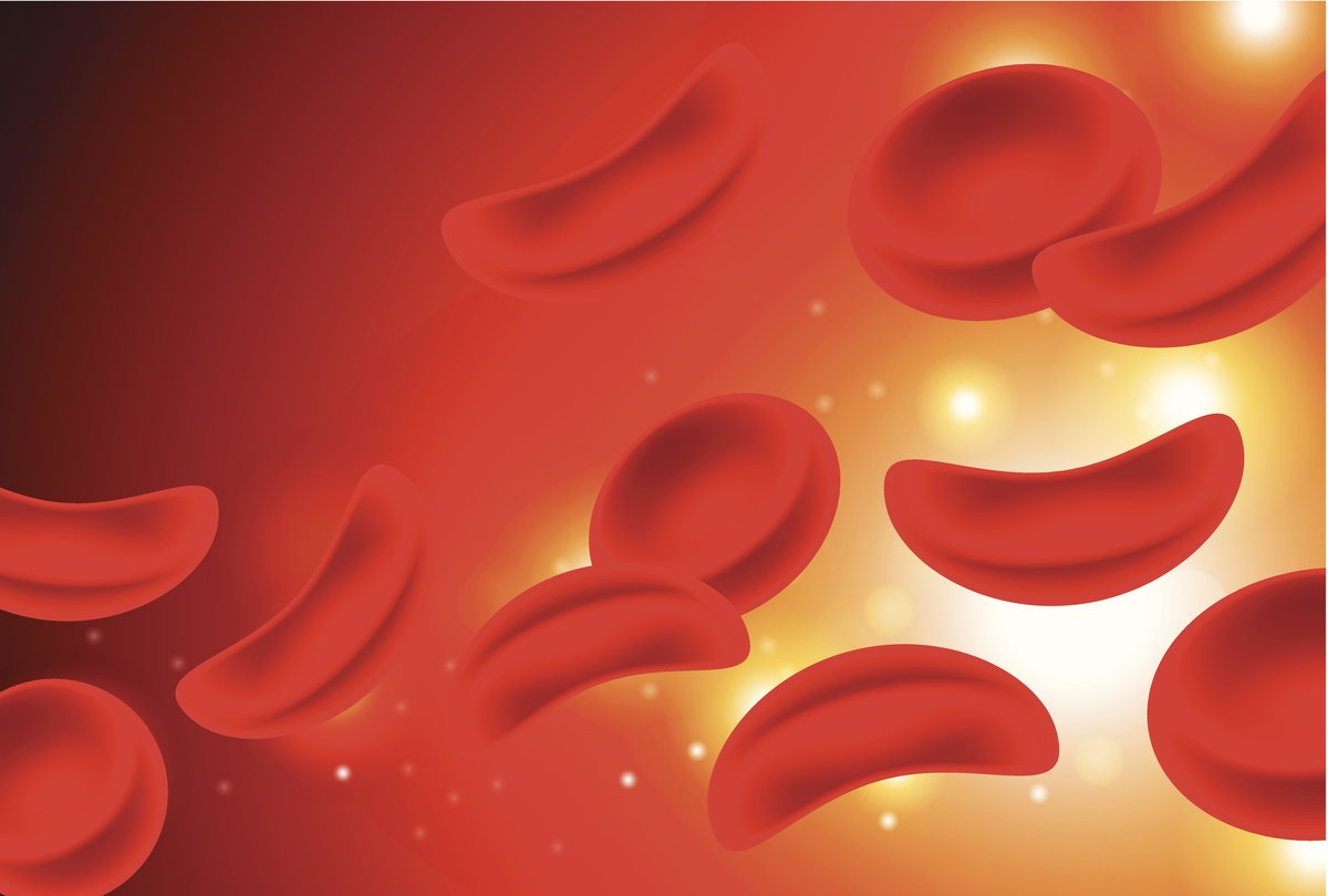 We're increasing #sicklecell disease education and training opportunities to improve outcomes for those living with the disease. Explore our #SCD benign hematology curriculum buff.ly/2At0acB #ConquerSCD #WorldSickleCellDay #WSCD20