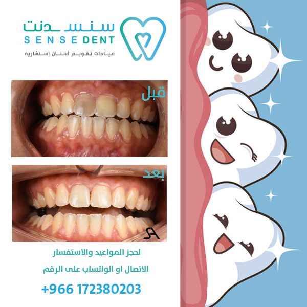 Sensedent عيادات سنسدنت Sensedent Twitter
