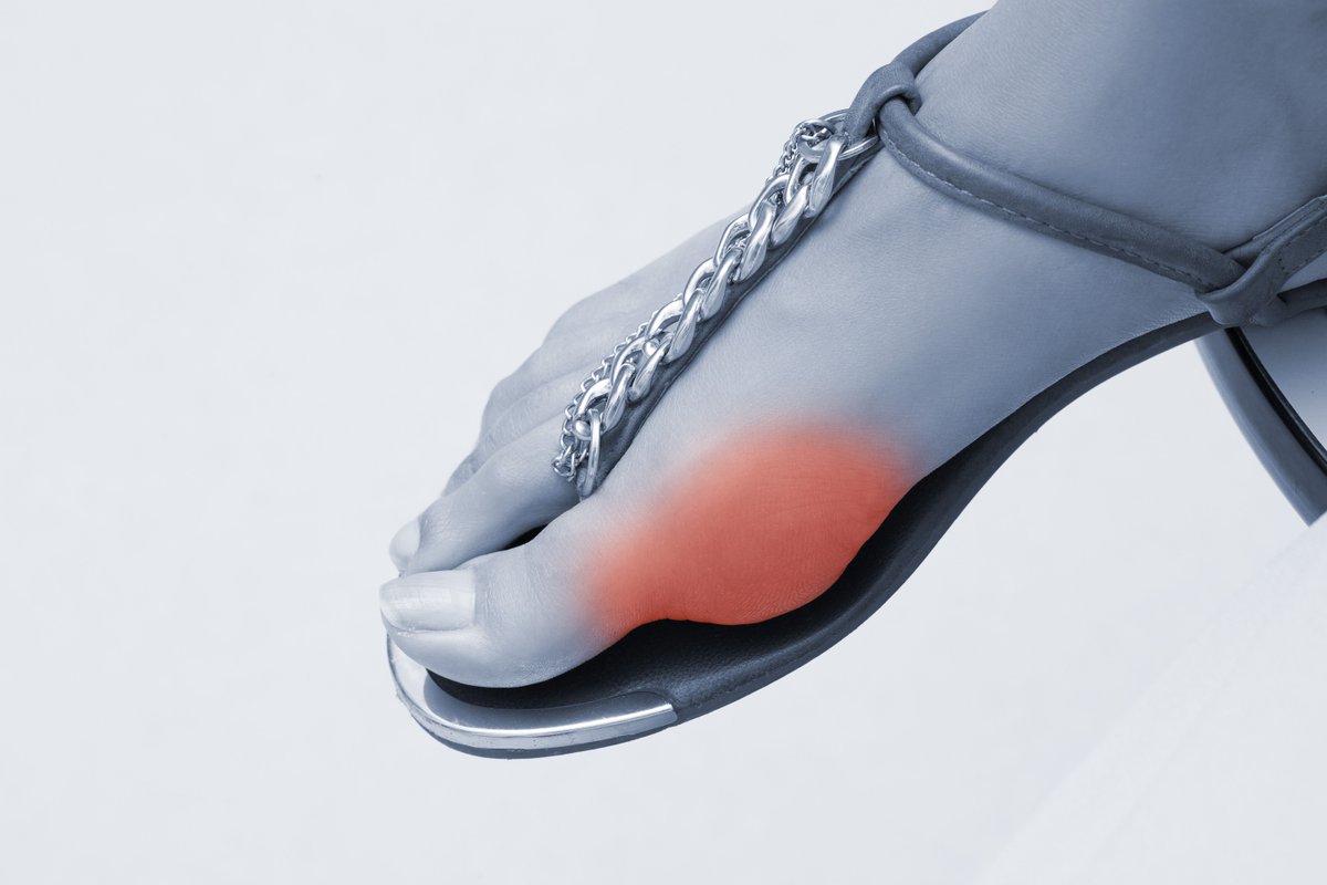 Did you know that today is National Flip Flop Day? With Summer just around the corner and flip flops being the pinnacle of Summer footwear it makes sense. But, what is gained in convenience is lost in protection.

Here's why you should ditch flip flops: buff.ly/2CoB0iW