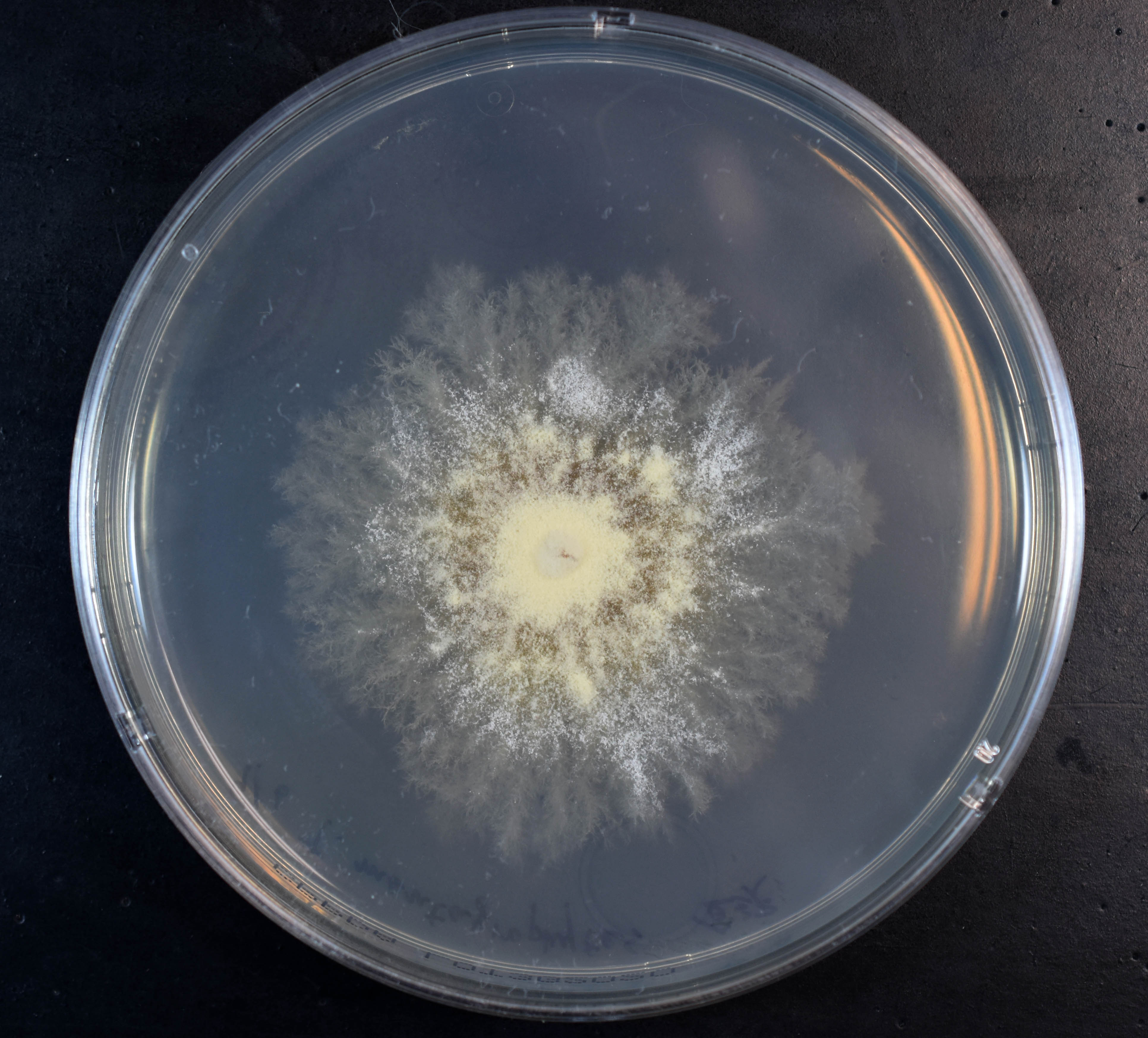 槇村 浩一 Prof Koichi Makimura Md Phd トリコフィトン インテルジギターレ かつての名前であったトリコフィトン メンタグロフィテスt Mentagrophytes 毛瘡菌 は今や別種 たまには巨大培養像 黄色調の粉っぽい集落表面をお楽しみ下さい