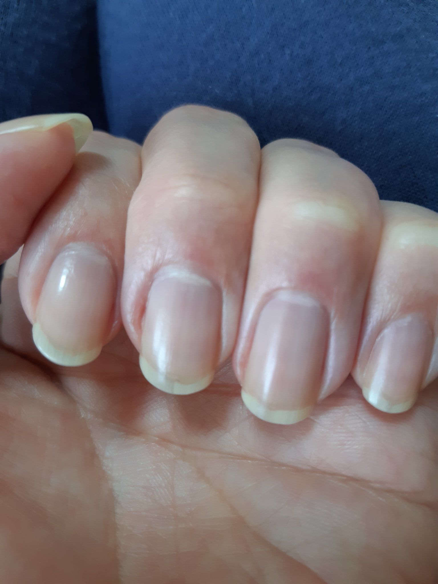 Nobu 多分過去最長 ネイルエンビーオフする前だから カーブがしっかりついてます T Co Kiqjbftzda Twitter Nobu 多分過去最長 ネイルエンビーオフする前だから カーブがしっかりついてます T Co Kiqjbftzda Twitter