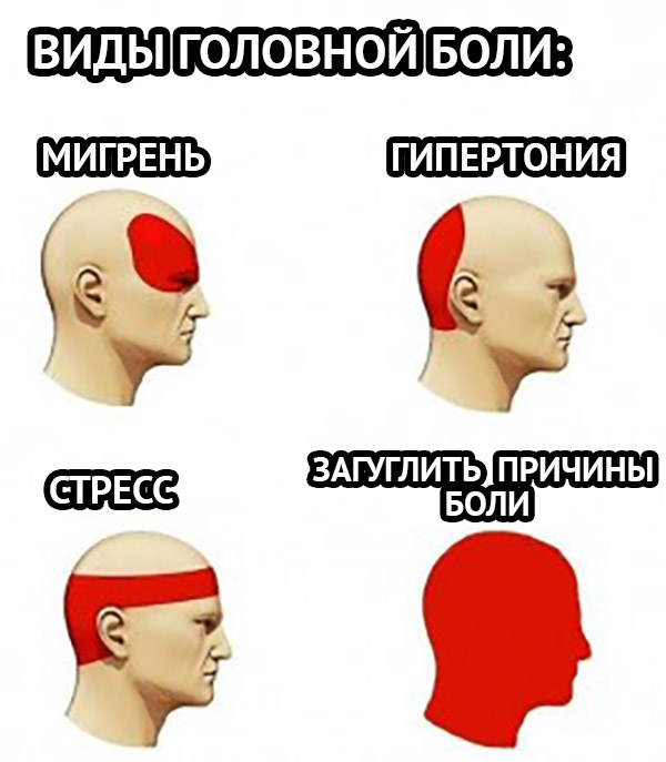 Какие причины головной боли. Головная боль. Типы головной боли. Боль в голове. Причины головной боли.