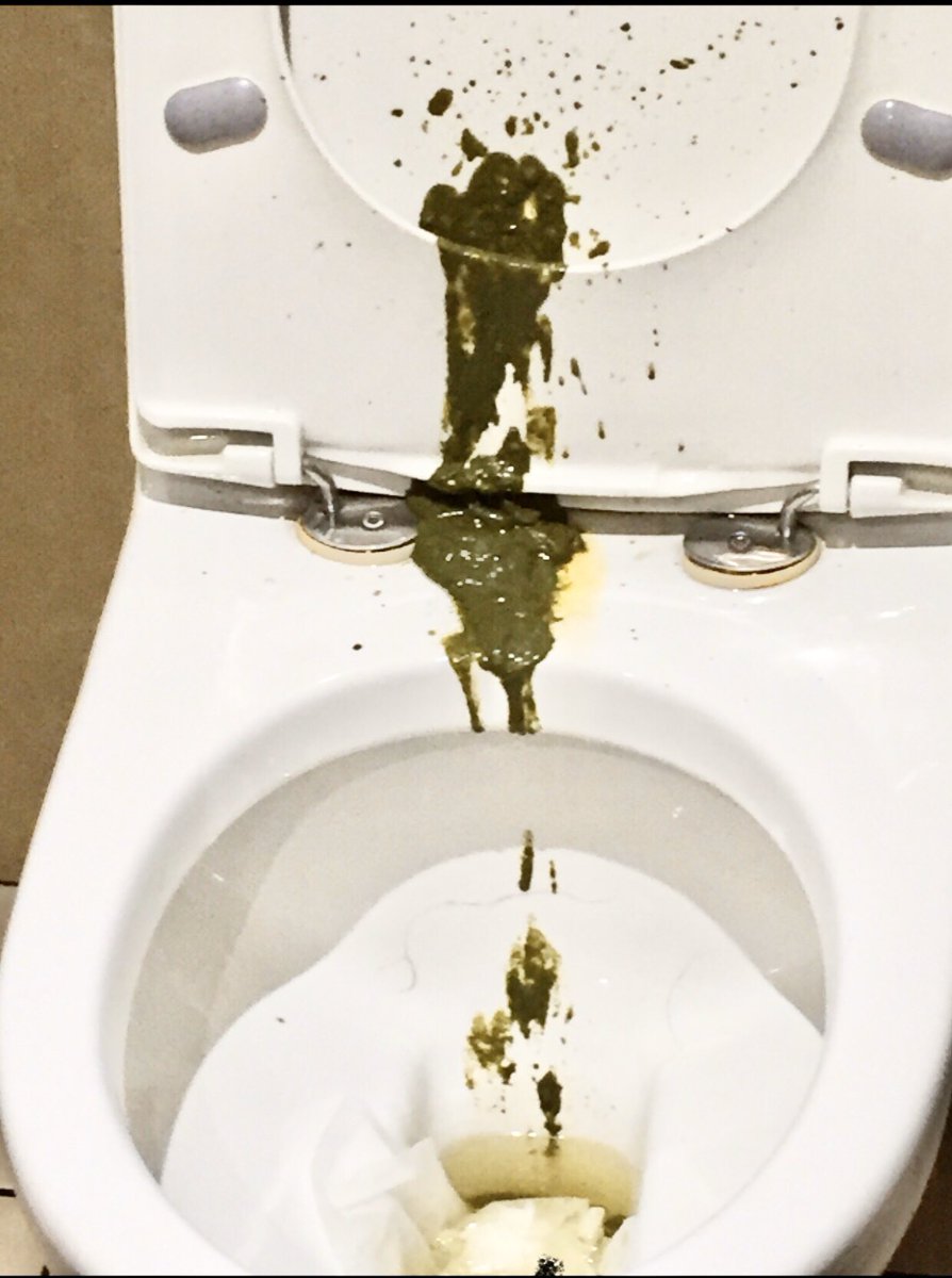 Sam Bargass (@sambargasss) on Twitter photo My toilet has better coverage then #Murdoch’s @FOXNRLLive! When will the #NRL start protecting players from harassment & sensationalist journalism of <a href="/FOXSportsNews/">FOX SPORTS News</a> & the <a href="/dailytelegraph/">The Daily Telegraph</a> ? #GoSouffs #NRLRabbitohsWarriors #NRLSouthsWarriors My toilet has better coverage then #Murdoch’s @FOXNRLLive! When will the #NRL start protecting players from harassment & sensationalist journalism of <a href="/FOXSportsNews/">FOX SPORTS News</a> & the <a href="/dailytelegraph/">The Daily Telegraph</a> ? #GoSouffs #NRLRabbitohsWarriors #NRLSouthsWarriors