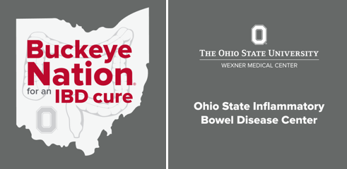 IBD_Afzali's tweet photo. It's time! Join in on the #VirtualTakeSteps @CCfdnCenOH @CrohnsColitisFn Who's in? Please RT with a photo of you and your family/friends! #WhyITakeSteps
#OSUIBDCENTER @OSUWexMed
@Buckeye4IBD @md_menon @Jskeans1 @drhanimani @AnaiziAhmad
#BuckeyeNationforIBDcure https://t.co/JIBs7gSbif