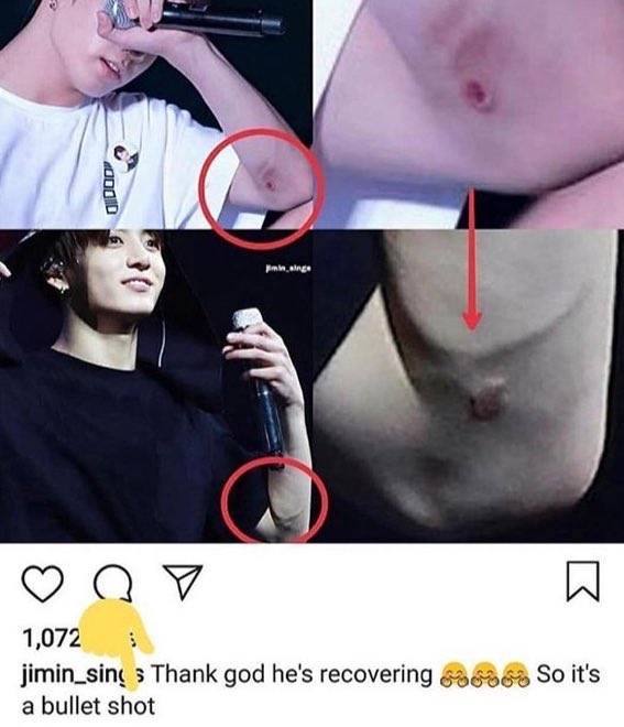 Instead of clarifying the incident in Thailand, BigHit has let for years people spread rumors like staff burned his arm with cigarretes or jokes like he was hurt by a bullet.