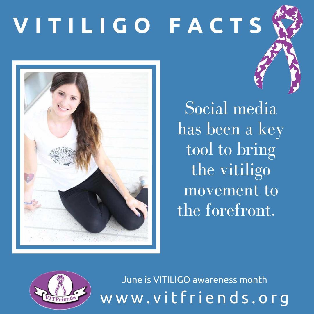VITFriendsBOS's tweet photo. VITILIGO FACTS
#vitiligo #vitfriends #skin #vitiligoworld #vitiligonation #vitiligopride #livingdappled #worldvitiligoday #vitiligoawarenessmonth https://t.co/7B9DfW0EDm