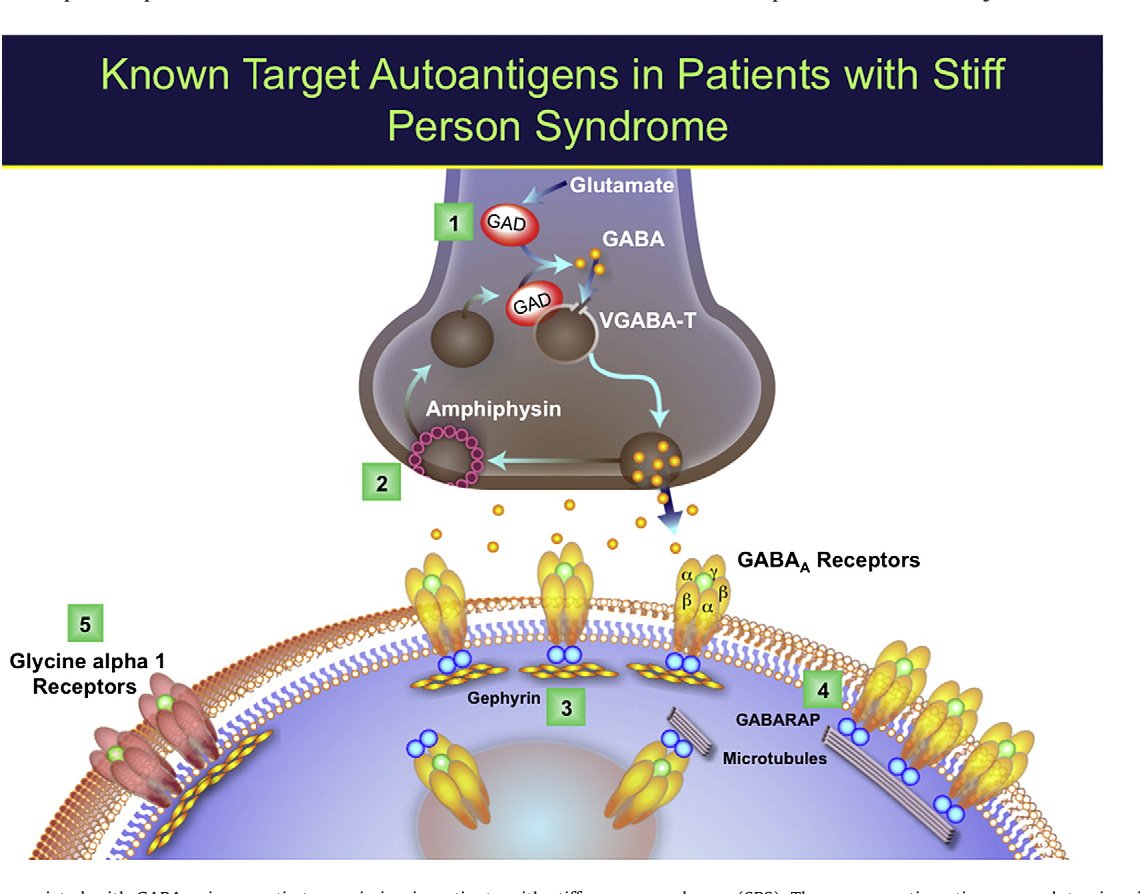 Stephan21213766's tweet photo. Benzo MOA: https://t.co/wUaganmJ0J

Summary: Stiff-man syndrome thought to be caused by antibodies against GABA transmission (inhibition of glutamic acid decarboxylase). 

For your viewing pleasure: 
 https://t.co/bHMP44sBWB

#HumanDx
#LECOMTweetorials https://t.co/ryuKnwh2Cs
