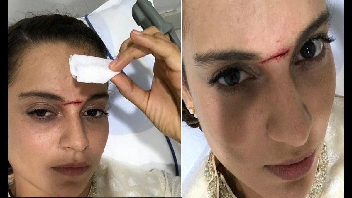  #Manikarnika There were blinds about how Kangana is faking her injuries to find excuses for delaying (cause of budget issues) or to gain insurance money. She got several injuries during Mani, one cut that she got from a sword still remains on her forehead