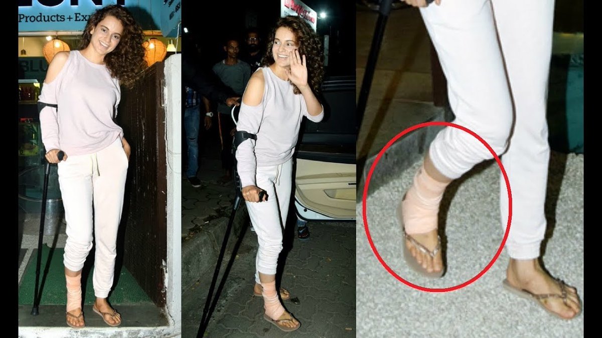  #Manikarnika There were blinds about how Kangana is faking her injuries to find excuses for delaying (cause of budget issues) or to gain insurance money. She got several injuries during Mani, one cut that she got from a sword still remains on her forehead