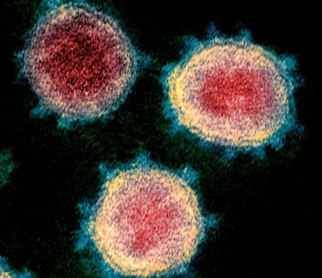 Are you convinced you had coronavirus in January, or even December? If you live in the North West, e-mail us detailing why you believe you had the virus, particularly if you've tested positive for antibodies. Please e-mail nwt@bbc.co.uk