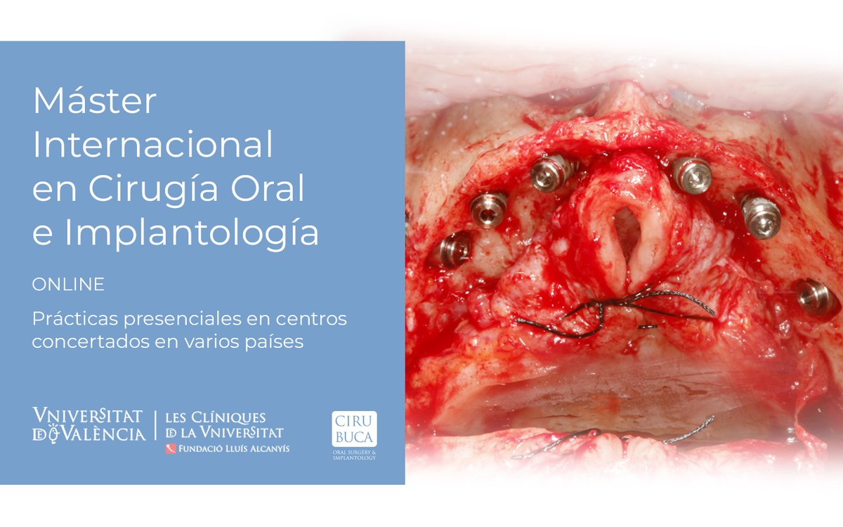 cirubuca's tweet photo. Máster Internacional en Cirugía Oral e Implantología 1ra edición Online
2020-2023 (180 ECTS) Inscripciones abiertas!!
Más información en: https://t.co/VNjdbYKpkC https://t.co/teTTrpco6K