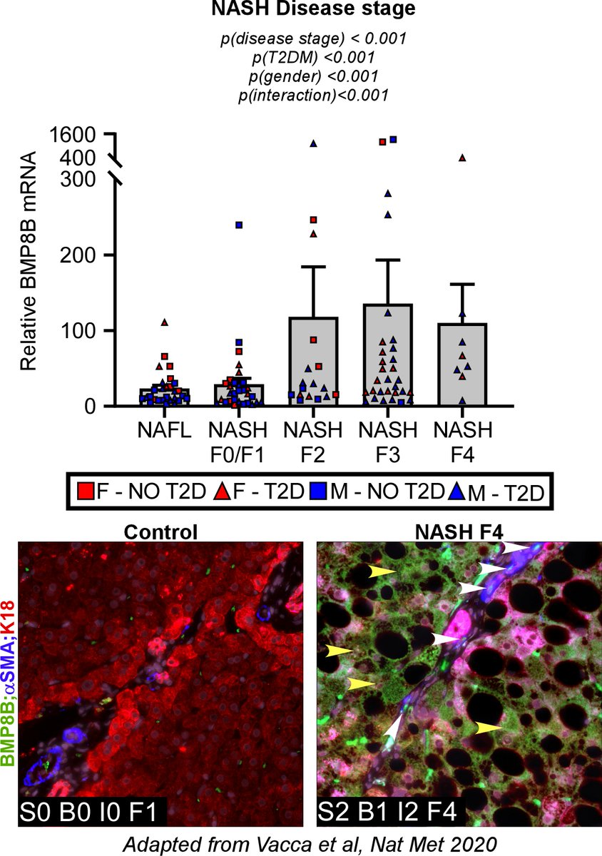 MikeVacca1979's tweet photo. Another piece in the puzzle of the complex regulation of #NASH progression by #TGF/#BMP signalling. @TVPLab @FibrosisLab @julesgrif @QAnstee @JLeslieScience @DinaTiniakos @wli225 @VladRatziu @CN_Bio @nordicbio @MRL_Cam @The_MRC @epos_nafld @CambridgeBRC 

https://t.co/bkLd6rFpFL https://t.co/F2Wpab8Ldy