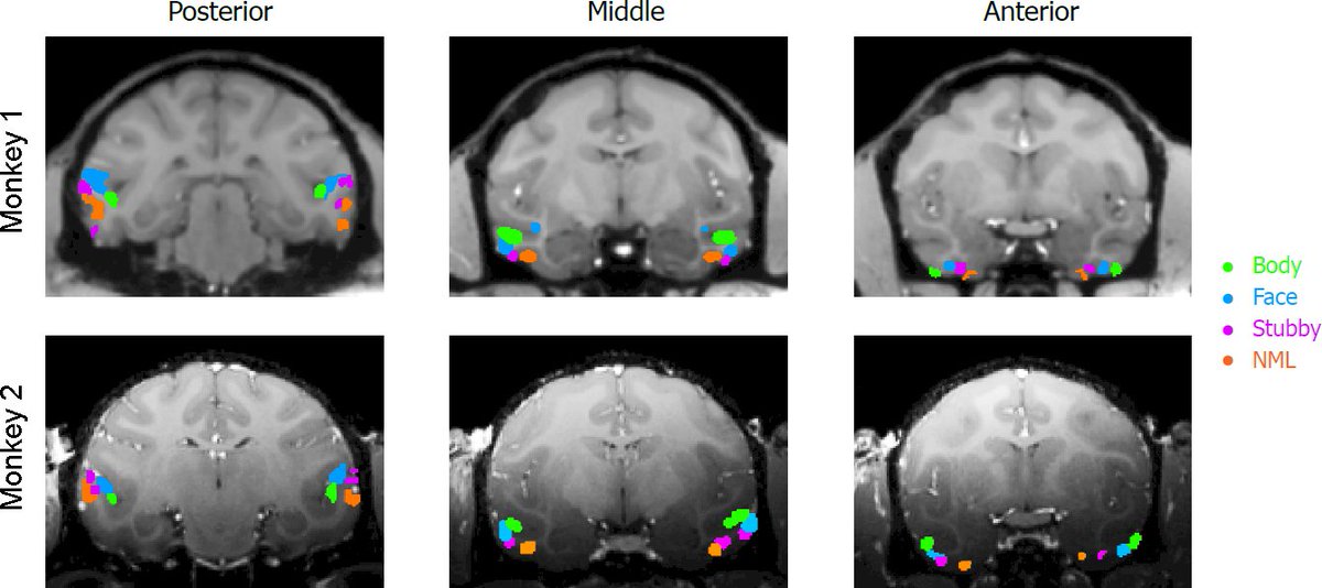 Doris Tsao (@doristsao) on Twitter photo 1/ Congratulations to Pinglei Bao <a href="/bobking/">Pinglei Bao</a> for a remarkable finding: IT cortex contains a coarse map of object space repeated 3 times. The maps comprise the known face & body networks plus two new networks.
nature.com/articles/s4158… 1/ Congratulations to Pinglei Bao <a href="/bobking/">Pinglei Bao</a> for a remarkable finding: IT cortex contains a coarse map of object space repeated 3 times. The maps comprise the known face & body networks plus two new networks.
nature.com/articles/s4158…