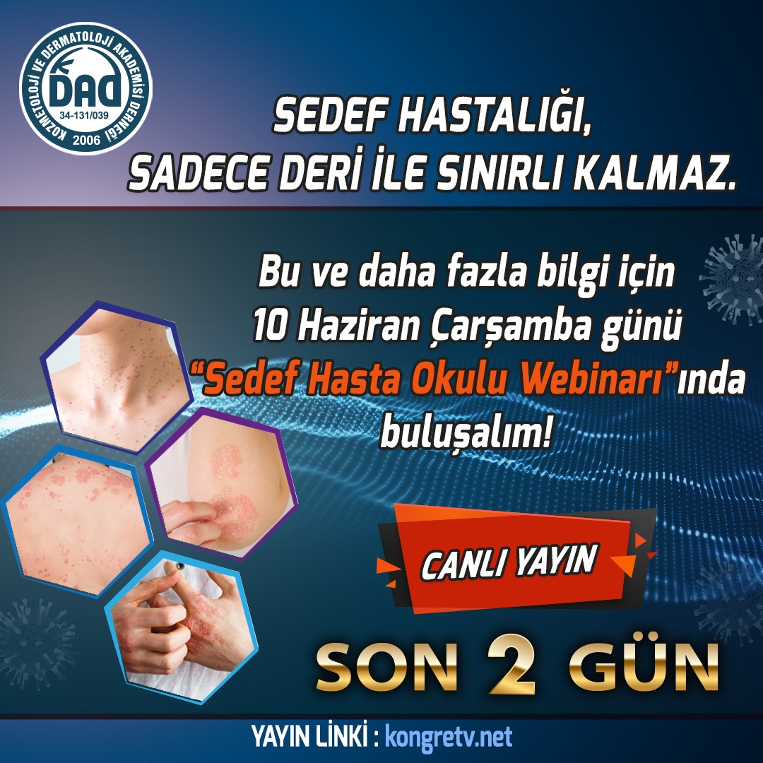 kozmetolojider's tweet photo. ‼️Halk arasında bilindiğinin aksine #sedefhastalığı ,deri ile kısıtlı kalan basit bir rahatsızlık değildir‼️
👉🏻Bu ve daha fazla bilgi için 🗓10 Haziran Çarşamba günü “ #SedefHastaOkulu Webinarı”ında buluşalım!
#sedef #sedefhastalığı #ciltproblemleri #onlineetkinlik
#KDAD https://t.co/1Js8jBK5CS