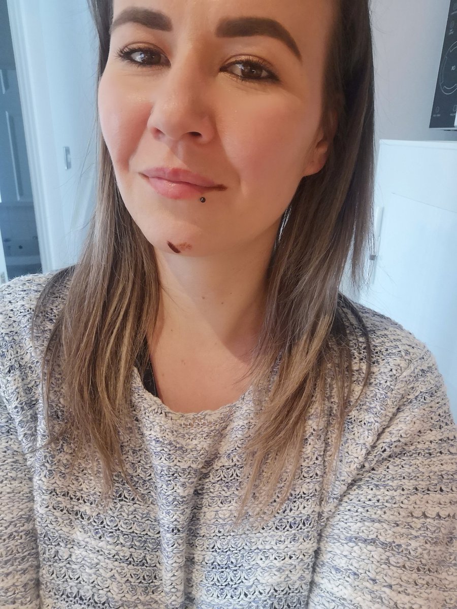 FocusFodmap's tweet image. Anyone else get covered in cake mixture when they bake? 🙋🙋‍♀️ #Baking #Chocolate #LactoseFree #GlutenFree #LowFodmap #MessyCook